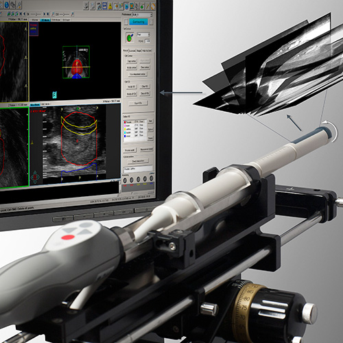 Real-time Prostate